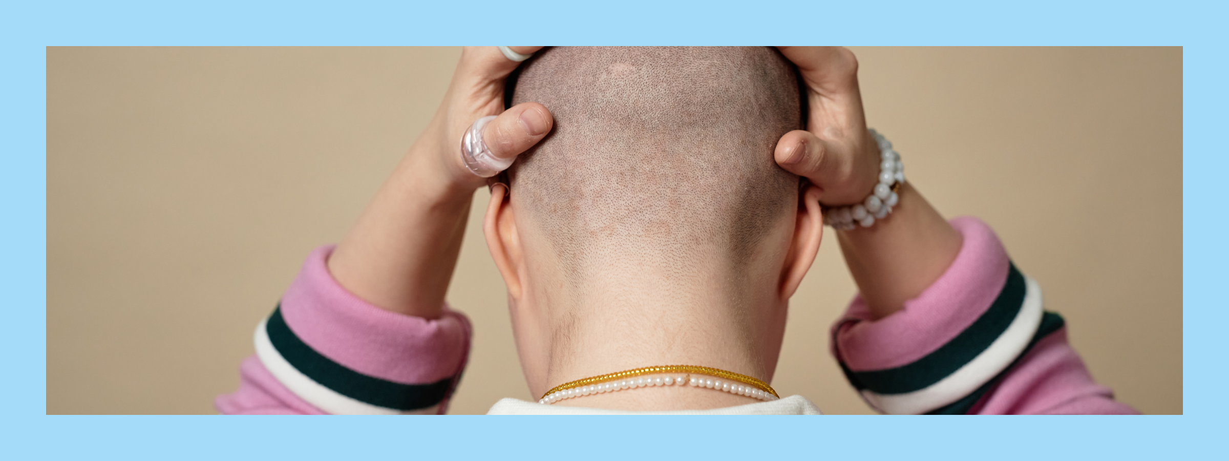 Chemo hair loss stages & timeline and what helps hair growth after chemo. Cancer treatment support & advice
