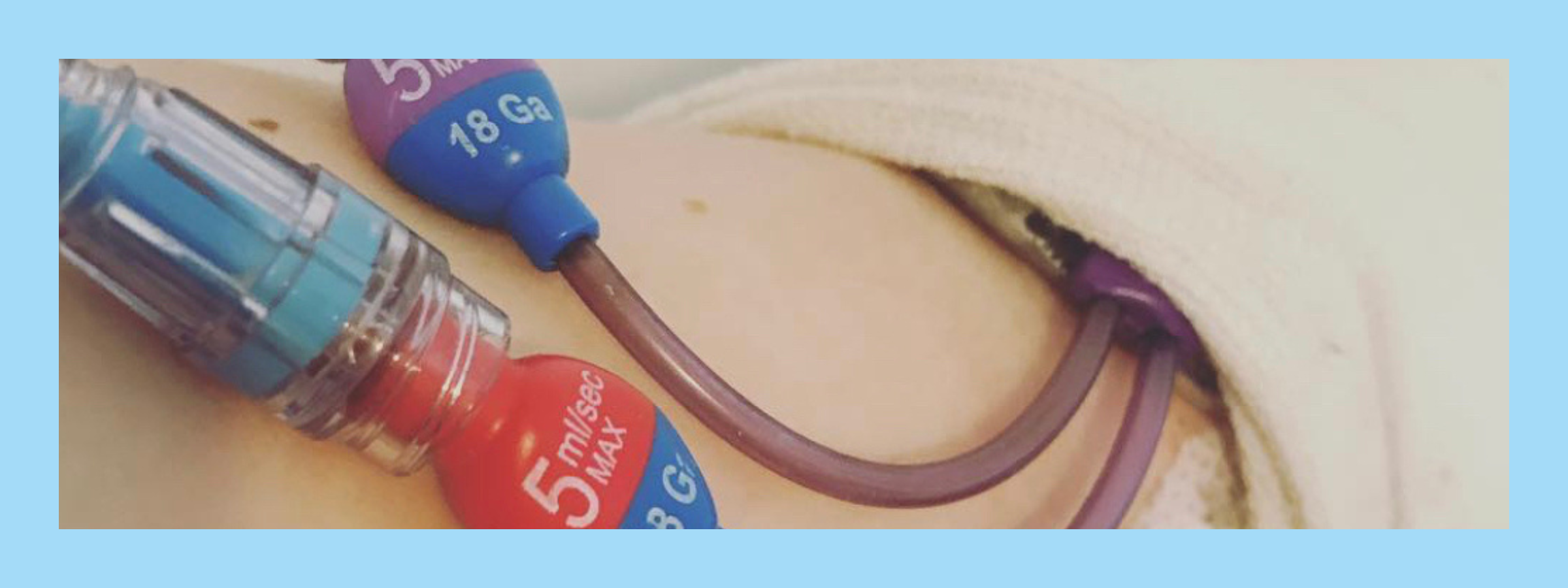 life with a picc line and what it means. Central line insertion